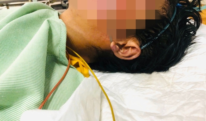 Bệnh nhân đang được điều trị tại bệnh viện. Ảnh: Vnexpress.