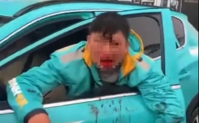 Tài xế xe ôm công nghệ bị đánh chảy máu mồm. (Ảnh: Dân Việt)