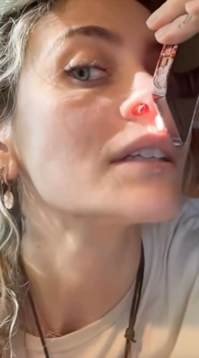 Tình trạng của ca sĩ Paris Jackson.