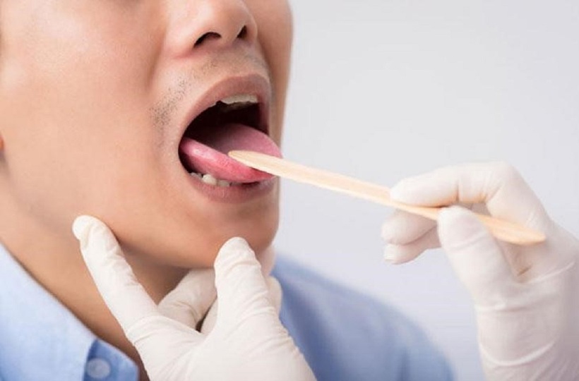 Đau họng do nhiều nguyên nhân gây ra