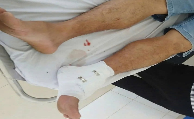 Cá sấu tấn công ông N.T.Tr., giáo viên trường THCS xã Thuận Mỹ (Tây Ninh). (Ảnh: HD).