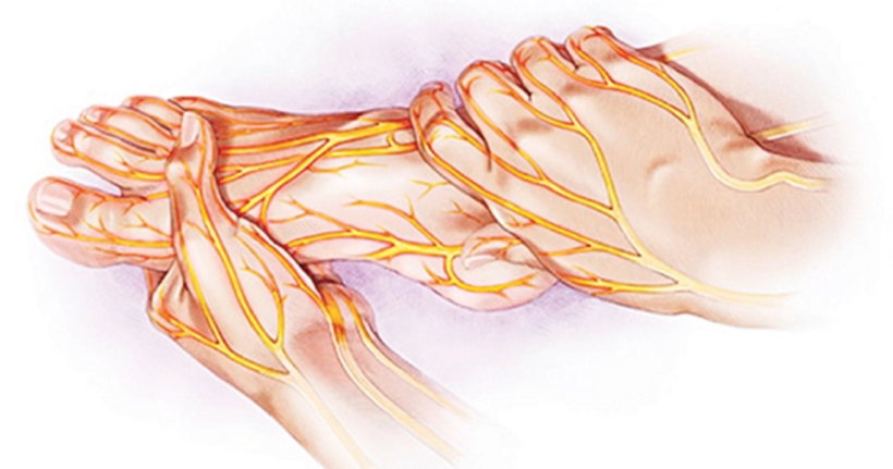 Tổn thương thần kinh gây tê bì chân tay ở người bệnh tiểu đường