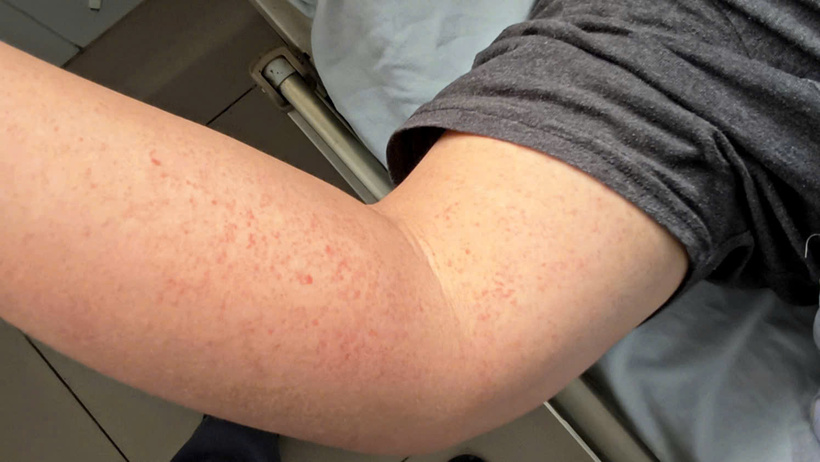 CDC cảnh báo nguy cơ xuất hiện thêm ổ dịch mùa đông xuân