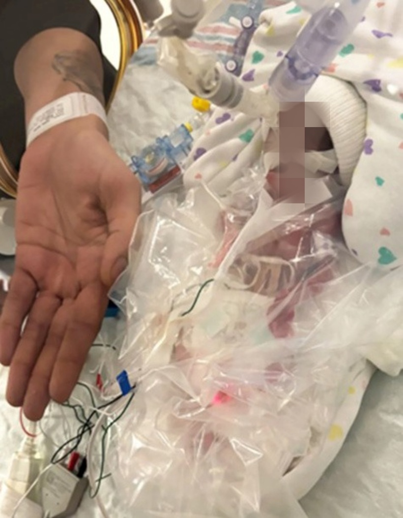 Ngay sau ca mổ, Essence Pinkney được chuyển thẳng đến phòng chăm sóc đặc biệt sơ sinh (NICU). Ảnh: Miya Vidal.