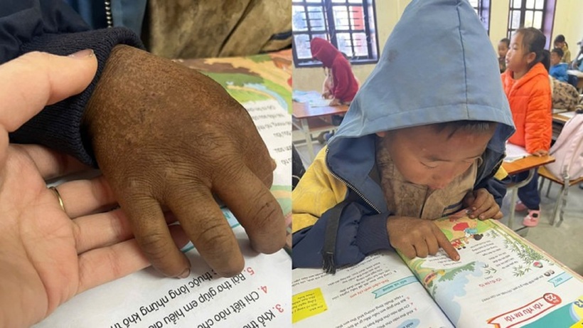 Hình ảnh bàn tay của cậu học trò khiến nhiều người xúc động. Ảnh: VTC News