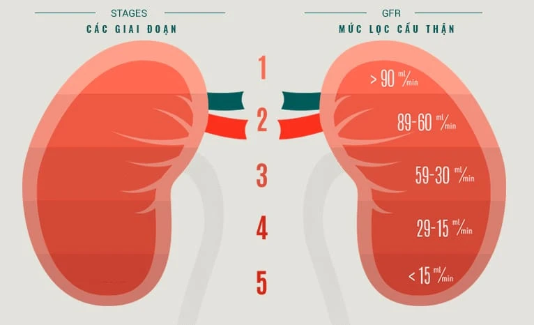 Các mức độ suy thận
