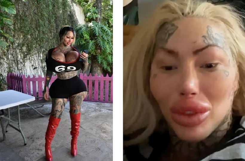 Nữ người mẫu nghiện "dao kéo" tử vong sau khi rơi từ ban công tầng 9. Ảnh: AOL.