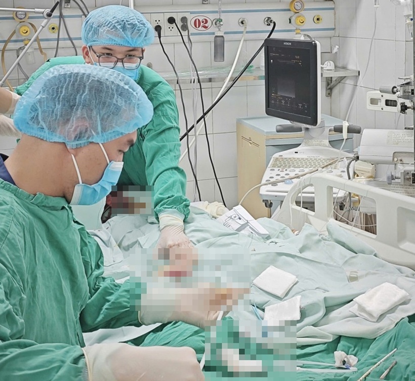 Các bác sĩ đang can thiệp CEMO để cứu tính mạng nữ giáo viên. Ảnh: Công an Nhân dân