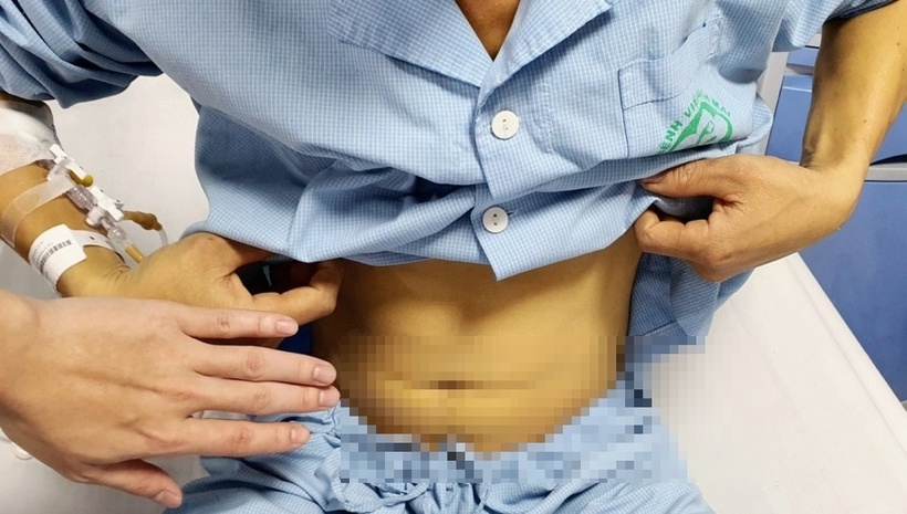 Bệnh nhân bị vàng da do suy gan vì uống mật cá trắm. Ảnh: VnExpress