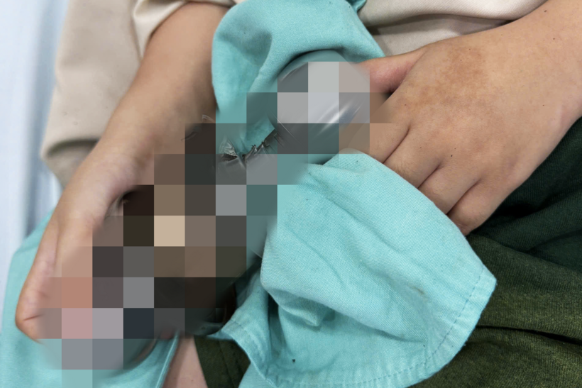 Bé trai được đưa vào viện trong tình trạng ngón tay kẹt chặt vào ổ khóa. Ảnh: Dân Trí.