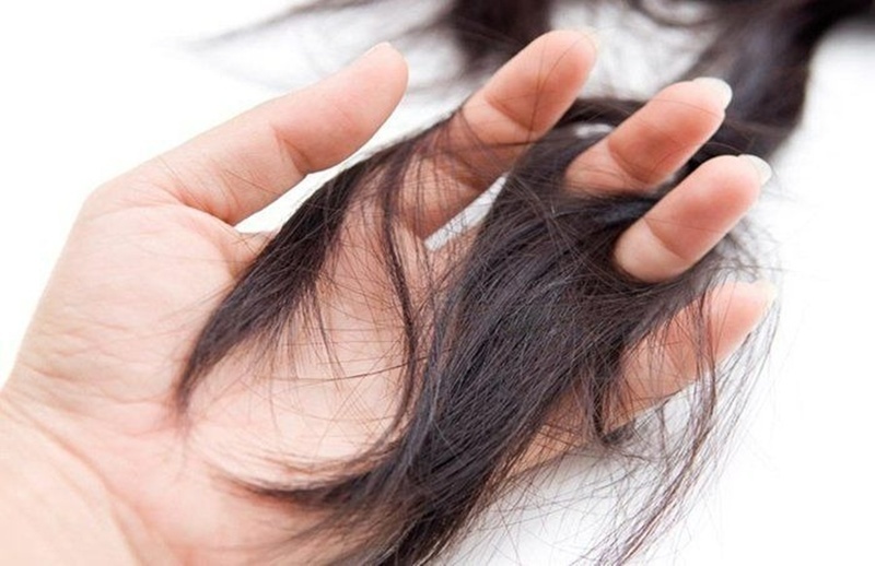 Tóc ở bệnh thận mạn tính thường giòn và khô, dễ gãy ngay cả khi chải nhẹ nhàng.