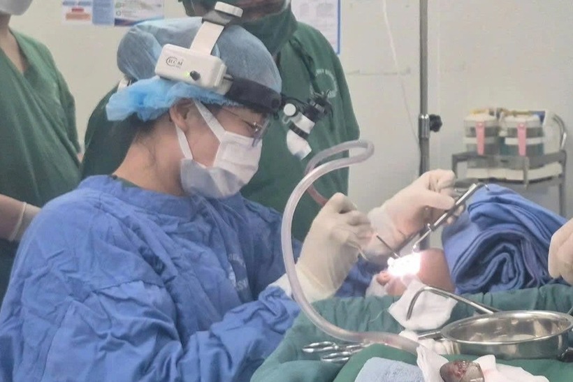 Các bác sĩ lấy dị vật ra khỏi đường thở của bệnh nhi. Ảnh: Dân Trí.