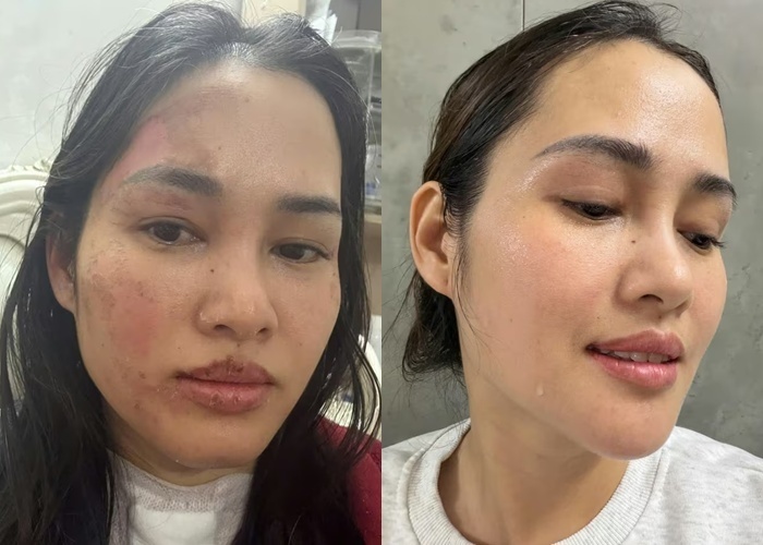 Khuôn mặt của Giang lúc bị bỏng và hiện tại. (Ảnh: Tạp chí Tri thức).