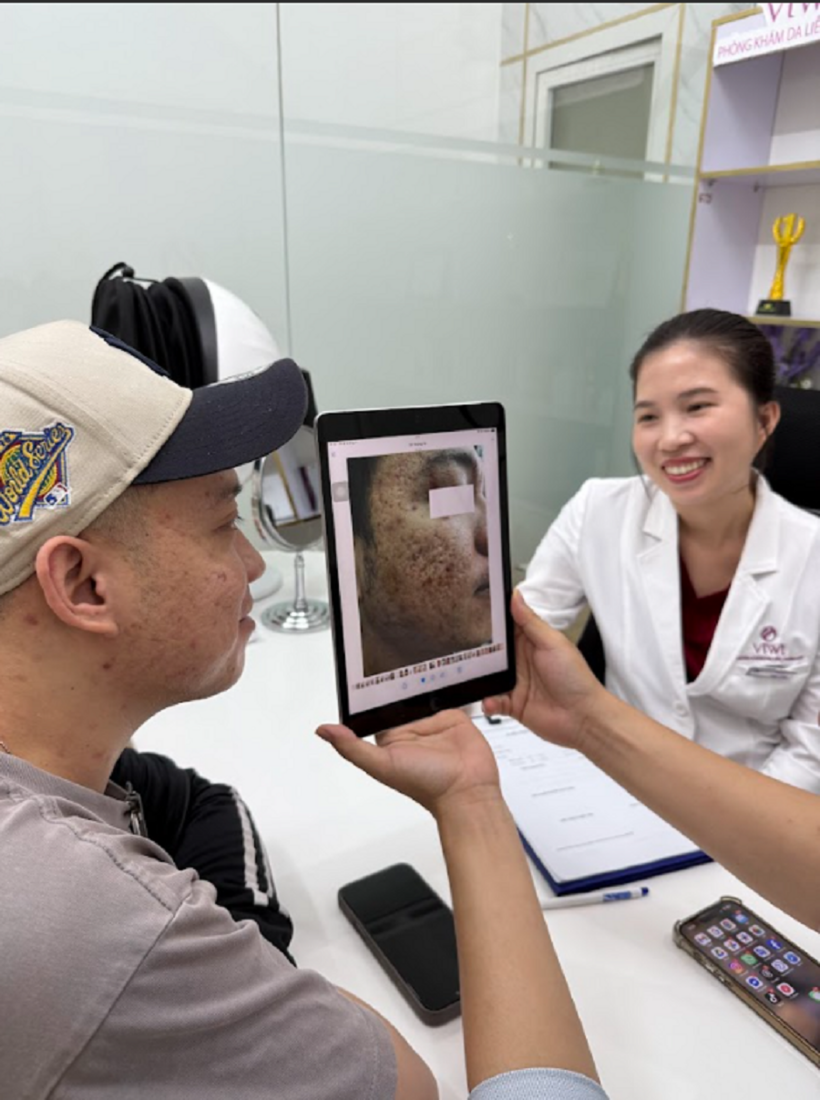 Phòng Khám Da Liễu ViWi Clinic - Nơi điều trị sẹo rỗ đặt chữ tâm lên hàng đầu - 5