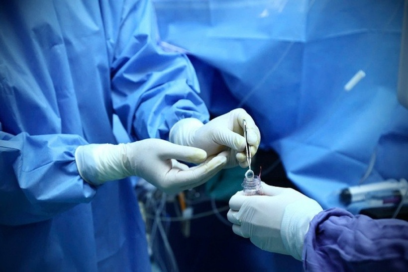 Các bác sĩ, điều dưỡng lần lượt lấy giác mạc người hiến. Ảnh: Người Lao Động.