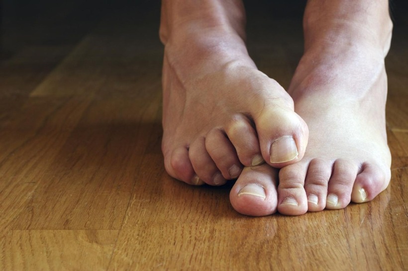 Hôi chân không chỉ là vấn đề ngoài da mà có thể là dấu hiệu thận yếu.