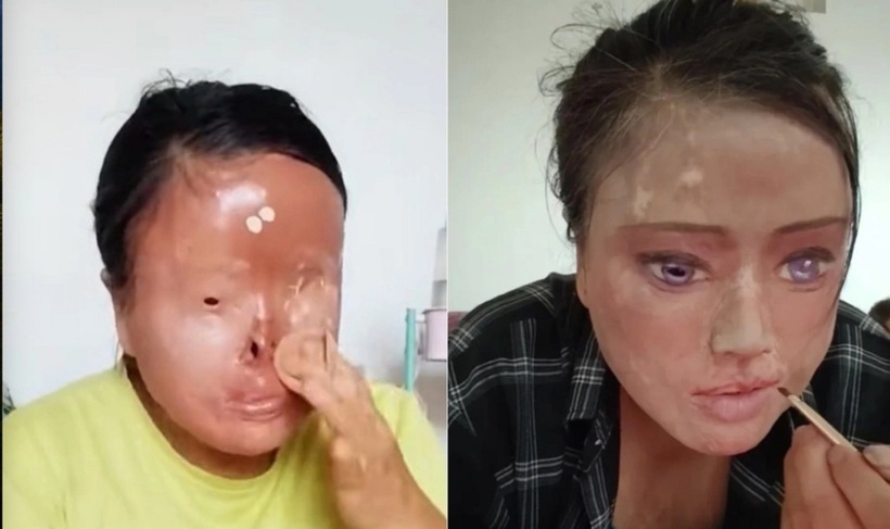 Từng muốn quyên sinh khi gương mặt bị axit hủy hoại hoàn toàn, Ah Hua tìm thấy ánh sáng cuộc đời nhờ những nét vẽ "giả mà thật" trên chính làn da sẹo của mình.