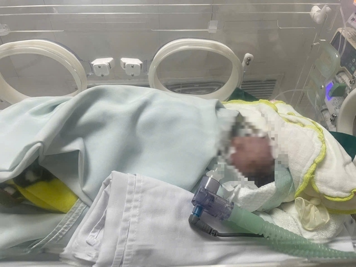 Trẻ sơ sinh sau khi được các bác sĩ Bệnh viện Nhi Thanh Hóa cấp cứu. (Ảnh: Người Lao Động).