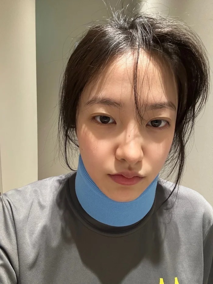 Yeri bị thương ở cổ.