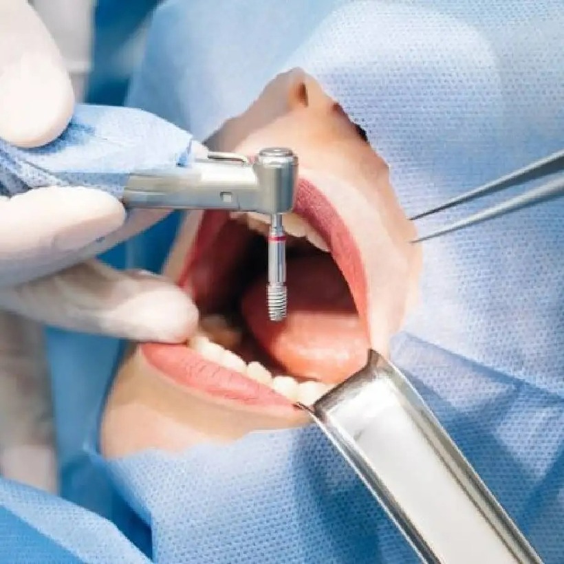 Người dân không tin vào các quảng cáo chữa tủy “siêu tốc”, “một lần là khỏi” tại các cơ sở giá rẻ, không rõ pháp lý.