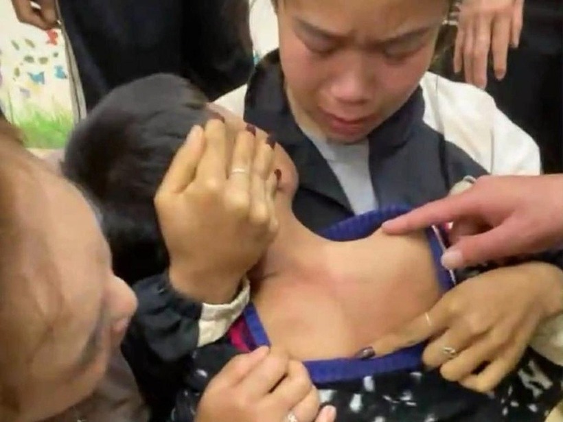 Gia đình kiểm tra người cháu bé sau sự việc. Ảnh: ZNews