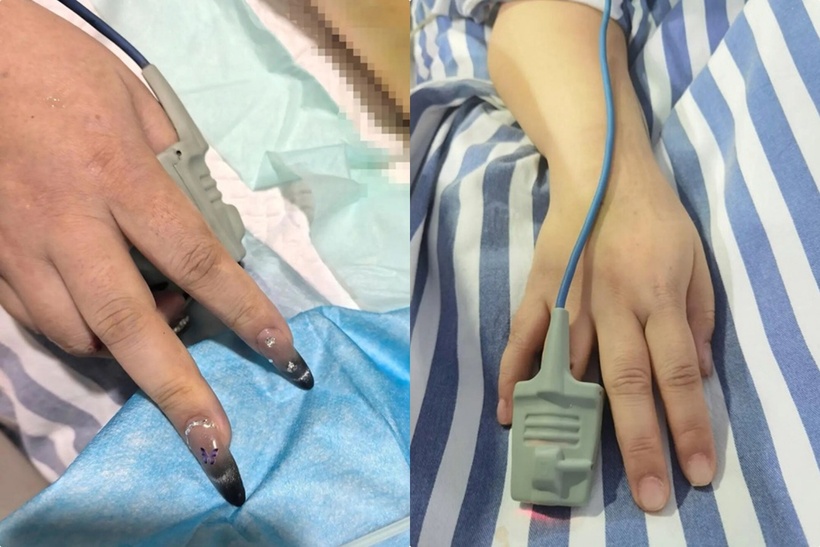 Bệnh viện đã khẩn cấp liên hệ với một thợ làm móng chuyên nghiệp, yêu cầu người này mang theo dụng cụ đến tận phòng cấp cứu. Ảnh: Sanxiang Metropolis Daily.