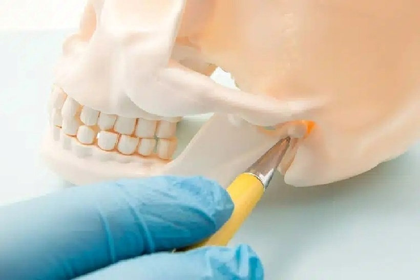 Không giống nhiều loại bệnh khác, u xương hàm thường tiến triển âm thầm trong thời gian dài.