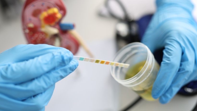 Nước tiểu bình thường có màu vàng hoặc trong.