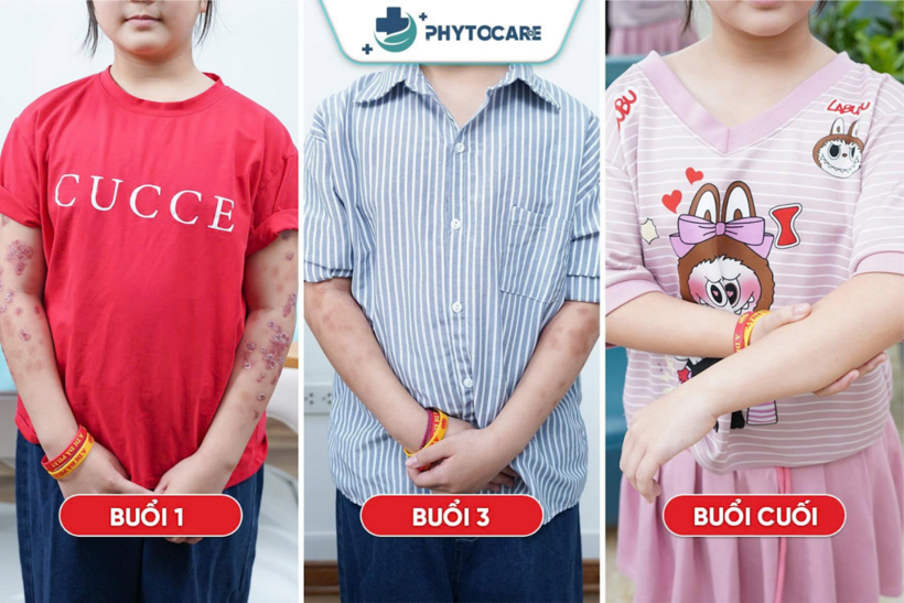 Tình trạng trước/sau của bệnh nhân tại Phòng khám