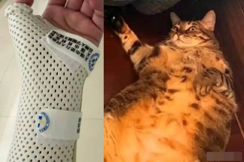 Người phụ nữ gãy xương cổ tay vì để mèo nặng 7,5kg gối đầu ngủ suốt đêm: Ảnh: Yangcheng Evening News.