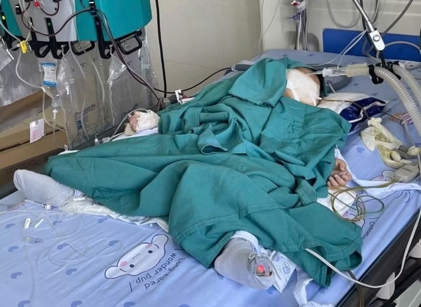 Sau hơn 2 tuần điều trị tích cực, sức khỏe bệnh nhi dần cải thiện và qua giai đoạn nguy hiểm. Ảnh: Báo Tiền phong.