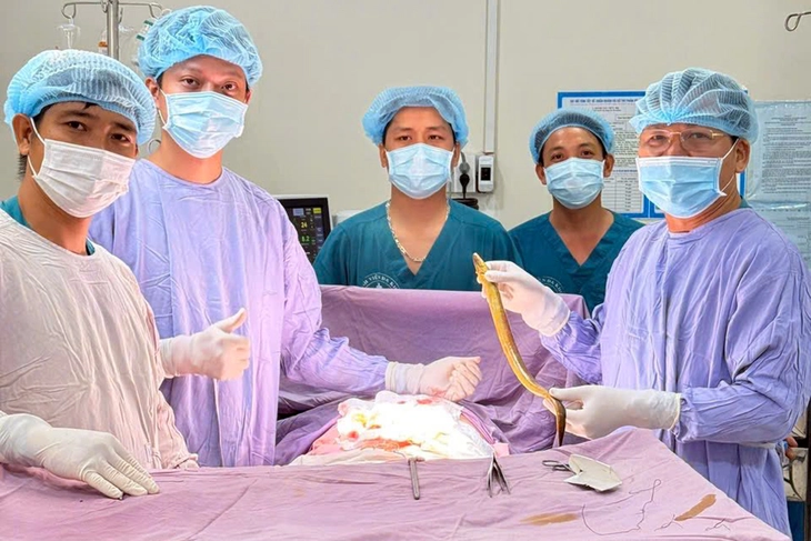 Y, bác sĩ Bệnh viện Đa khoa Thống Nhất Đồng Nai mổ lấy con lươn dài hơn 50cm khỏi ổ bụng nam bệnh nhân. (Ảnh: Bệnh viện Đa khoa Thống Nhất Đồng Nai)