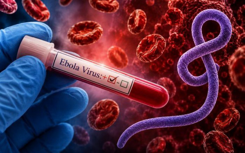 Nguy cơ bệnh Ebola xâm nhập vào Việt Nam hiện tại được đánh giá là thấp nhưng người dân cũng không nên chủ quan với các biện pháp phòng chống dịch bệnh. Ảnh chỉ mang tính minh họa