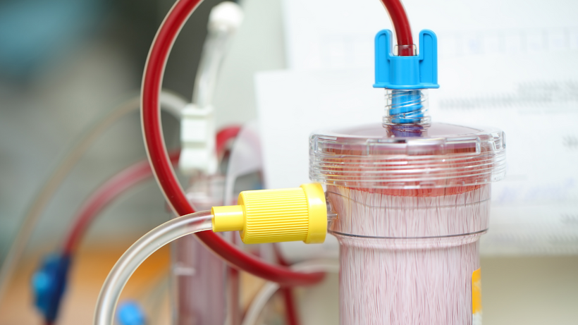 Suy thận độ 4 cần điều trị tích cực để ngăn nguy cơ phải lọc máu chu kỳ