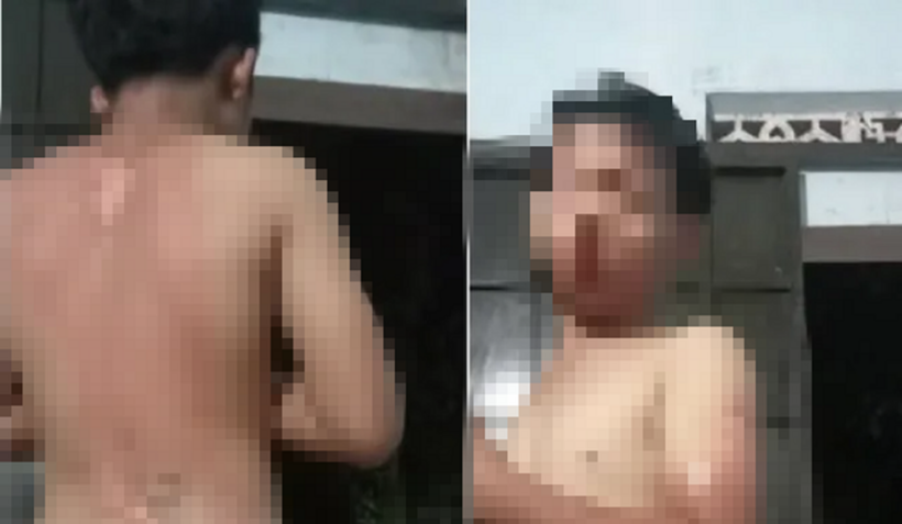 Cơ quan công an vào cuộc vụ bé trai bị mẹ ruột tạt nước sôi gây bỏng ở Đắk Lắk. Ảnh: Thanh Niên