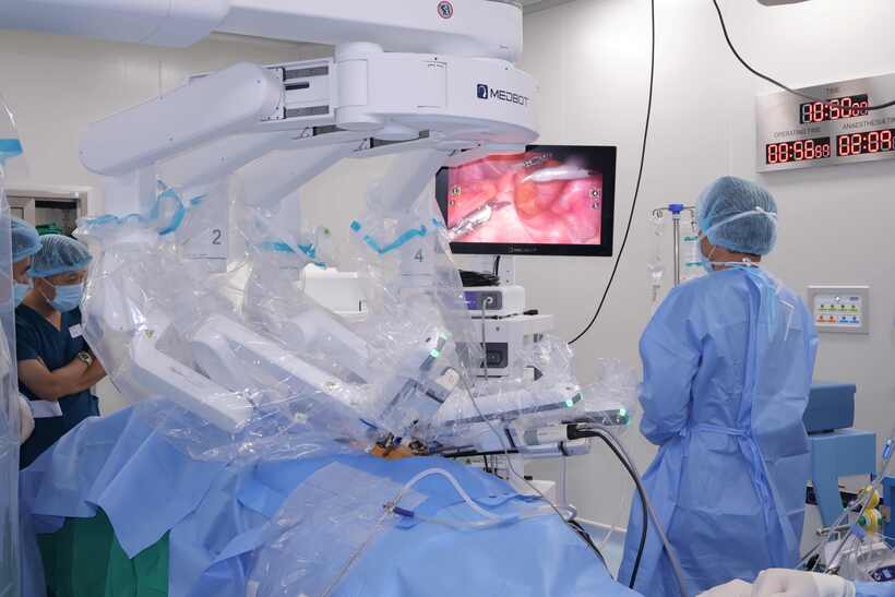 Sau quá trình hóa xạ trị, bệnh nhân được chuyển về Vinmec Cần Thơ để phẫu thuật cắt trước thấp trực tràng bằng phương pháp nội soi với sự hỗ trợ của robot Toumai MT-1000.