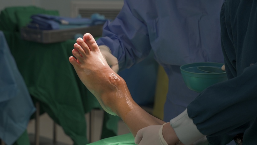 Khối u âm thầm phá huỷ đến 80% thể tích xương sên của người bệnh, gây ra những cơn đau đầy ám ảnh. (Ảnh: Vinmec)