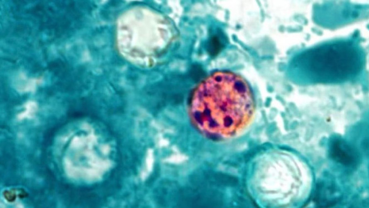 Mô phỏng ký sinh trùng Cyclospora. Ảnh: CDC Mỹ
