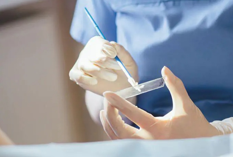 Nhận diện sớm dấu hiệu bất thường ở cổ tử cung bằng kỹ thuật đơn giản. Ảnh: Bệnh viện đa khoa Phương Đông
