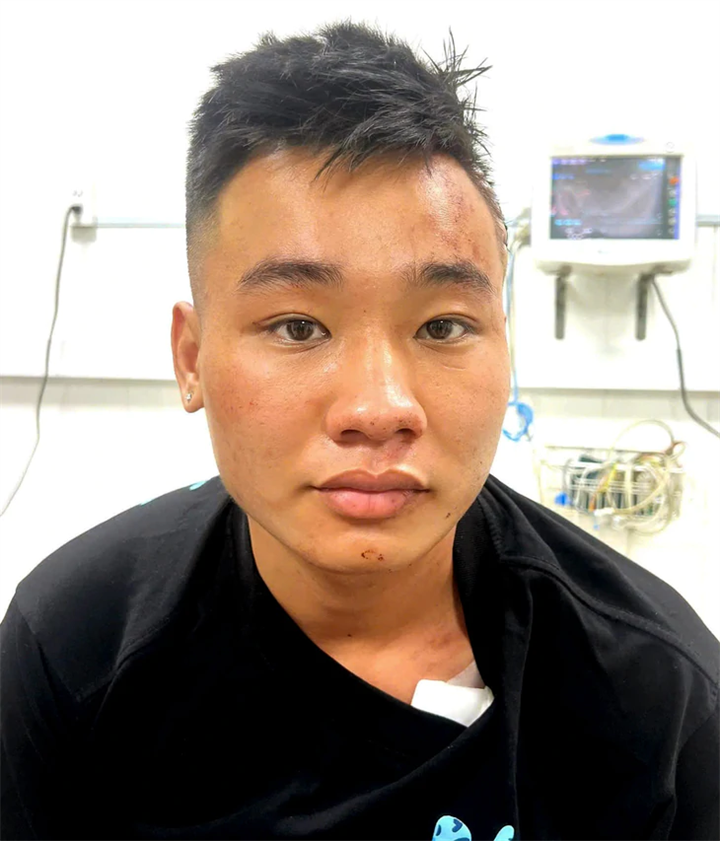 Đối tượng Nguyễn Đức Anh. Ảnh: Công an Đồng Nai
