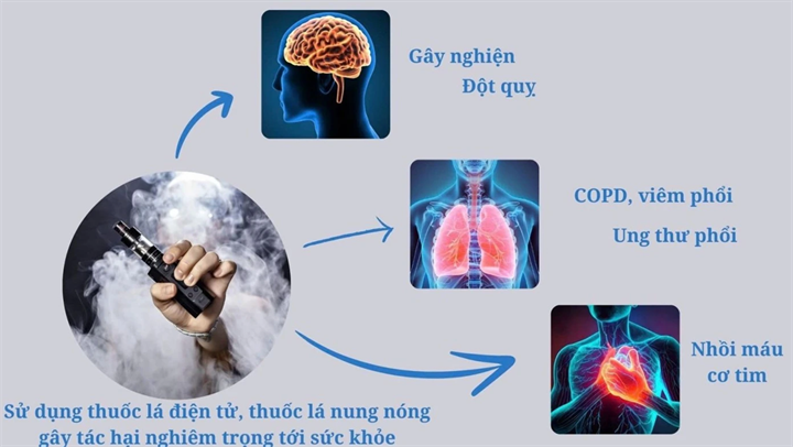Thuốc lá điện tử và thuốc lá nung nóng tiềm ẩn nhiều nguy cơ đối với sức khỏe. Ảnh: Công an Phú Thọ.