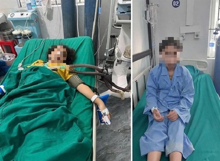 Hình ảnh bệnh nhi 12 tuổi được cấp cứu và theo dõi điều trị tại bệnh viện. Ảnh: BVCC