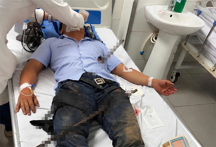 Bệnh nhân nhập viện trong tình trạng 2 thanh sắt đâm xuyên người. Ảnh: Dân trí