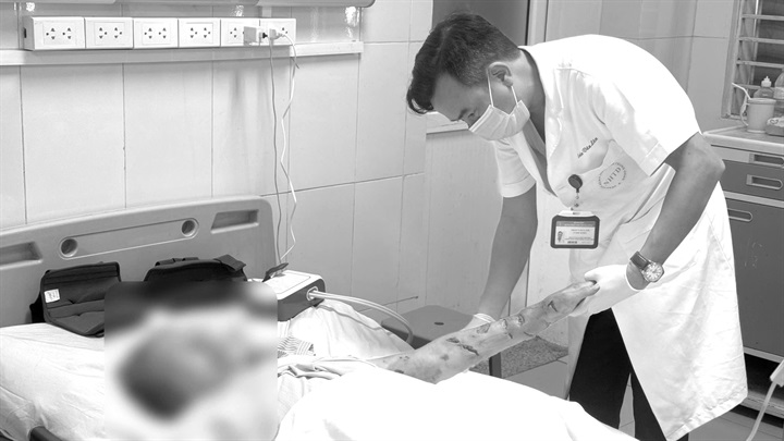 Bác sĩ cảnh báo nguy cơ từ chó cắn ở người già, người liệt và hạn chế vận động. Ảnh: BVCC