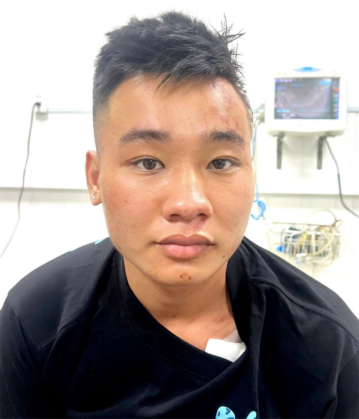 Đỗi tượng Nguyễn Đức Anh. Ảnh: Vietnamnet