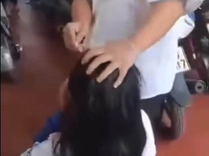 Nữ sinh bị bạn cùng lớp đánh, bị dí điếu thuốc đang cháy sát vào mặt ở Đắk Lắk. Ảnh: Thanh niên