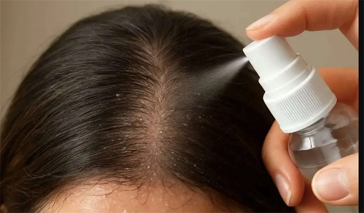 Một sản phẩm xịt dưỡng tóc hương nước hoa bị thu hồi do nhãn mỹ phẩm ghi công dụng không đúng với hồ sơ đã được duyệt và không đúng bản chất sản phẩm (Ảnh minh họa: iStock).