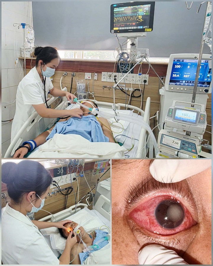 Bác sĩ cảnh báo tổn thương phổi, mắt có thể tiến triển nhiều giờ sau khi hít phải khí clo. Ảnh: BVCC