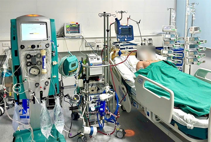 Nam thanh niên 23 tuổi nguy kịch vì sốt xuất huyết dù không có bệnh nền. Ảnh: BVCC