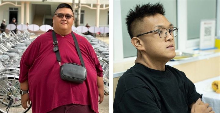 Bệnh nhân trước và sau khi giảm cân. Ảnh: NVCC/Vietnamnet